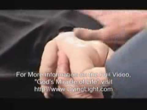 Partial-Birth Abortion Procedure With Real Instruments - Pro-Life Anti-Abortion Video